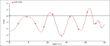 アウターパネルのたわみ（Z方向）結果例